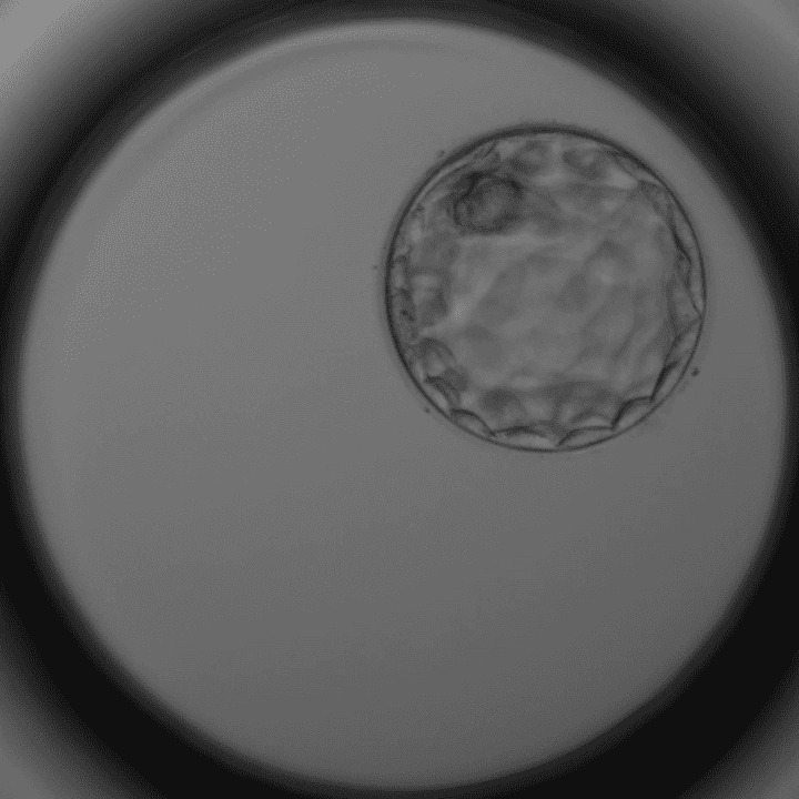 Blastozyste Tag 5: Embryo mit über 100 Zellen, innere Zellmasse und Trophoblast – Kinderwunschklinik Dr. Pavlik