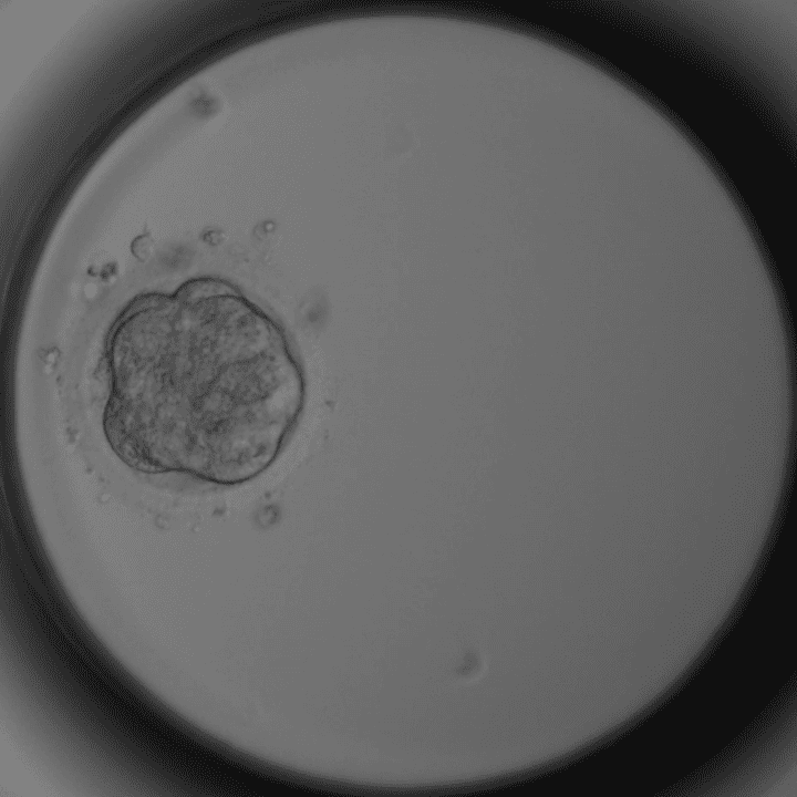 Morula-Stadium Tag 4: Kompaktierter Embryo, Zellen nicht mehr einzeln erkennbar – Kinderwunschklinik Dr. Pavlik