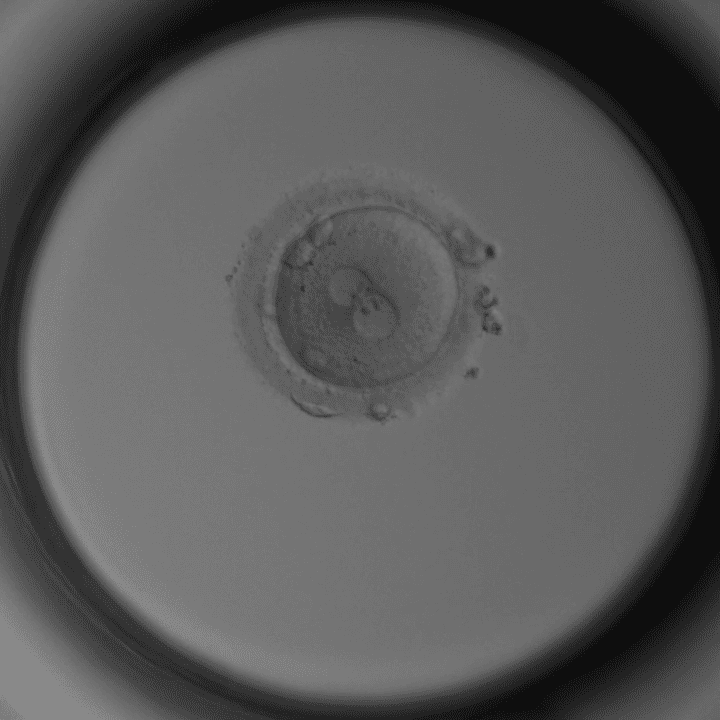 Pronukleaten-Stadium Tag 1: Befruchtete Eizelle mit zwei Vorkernen unter dem Mikroskop – Kinderwunschklinik Dr. Pavlik